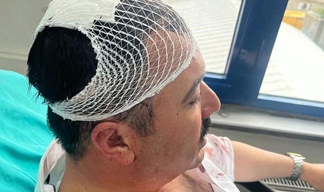 Belediye başkan yardımcısını şekerlikle yaralayan YRP'li başkan yardımcısı tutuklandı