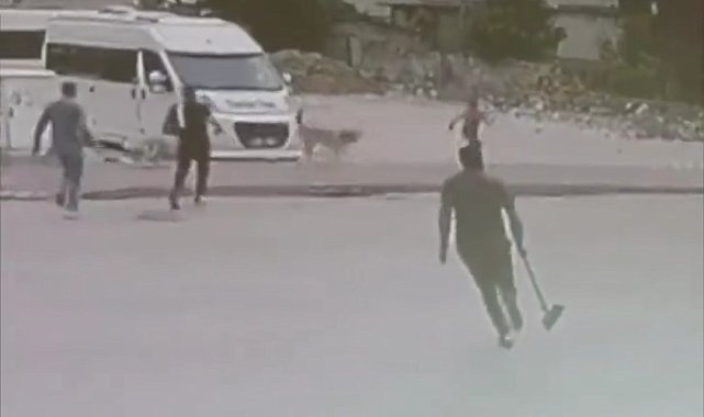 Sokak köpekleri çocuğa saldırdı
