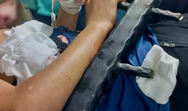 Ağaçtan düşen çocuk korkuluk demirlerine saplandı