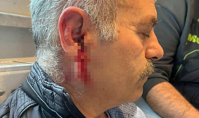 Silivri'de özel bakım merkezine çağrılan eski çalışan darbedildi