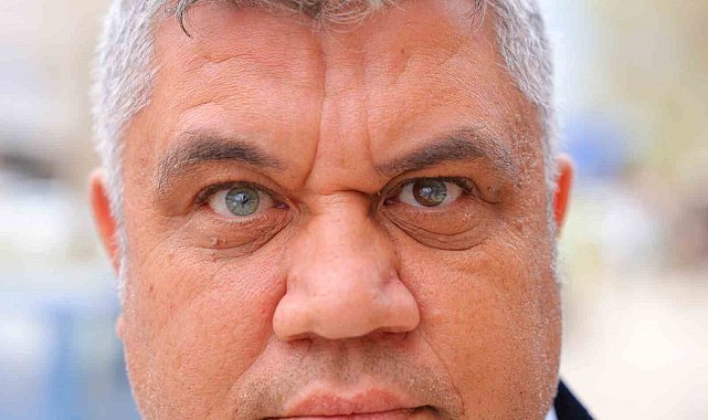 Kahramanmaraşlı adam 3 renkli gözleriyle görenlerin ilgisini çekiyor