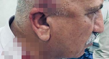 Kerkük'te kaçak yapı yıkımı sırasında kaymakama bıçaklı ve sopalı saldırı