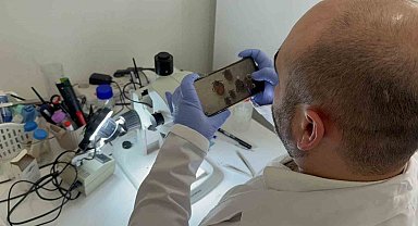 Tokat'ta uzmanından kene uyarısı: İklim düzensizliği ve küresel ısınma kene sezonunu uzatıyor