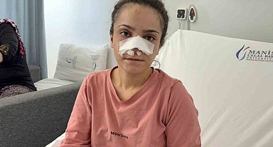 Eşinin kopardığı burnu başarılı operasyonla yerine dikildi